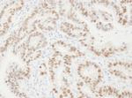 PCNA Polyclonal Antibody