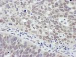 MTA1 Polyclonal Antibody