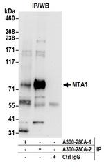 MTA1 Antibody in Immunoprecipitation (IP)