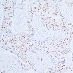 Rad6 Polyclonal Antibody