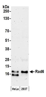 Rad6 Polyclonal Antibody