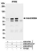 HdmX/MDM4 Antibody in Immunoprecipitation (IP)