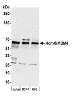 HdmX/MDM4 Polyclonal Antibody