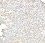 hSET1 Polyclonal Antibody