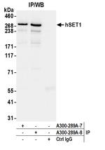 hSET1 Antibody in Immunoprecipitation (IP)