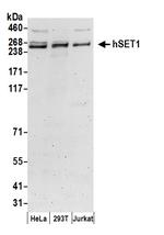 hSET1 Polyclonal Antibody