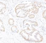 Caper Polyclonal Antibody