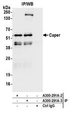 Caper Antibody in Immunoprecipitation (IP)