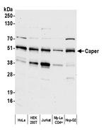 Caper Antibody in Western Blot (WB)