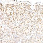 FUS Antibody in Immunohistochemistry (Paraffin) (IHC (P))