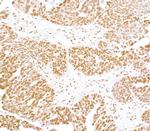 FUS Polyclonal Antibody