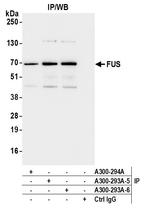 FUS Antibody in Immunoprecipitation (IP)