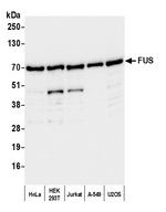 FUS Antibody in Western Blot (WB)