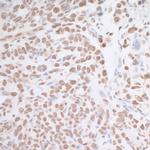 MAD2 Polyclonal Antibody