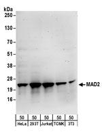 MAD2 Polyclonal Antibody