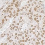 FUS Polyclonal Antibody