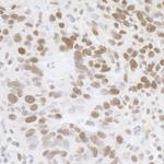 FUS Antibody in Immunohistochemistry (Paraffin) (IHC (P))