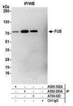 FUS Antibody in Immunoprecipitation (IP)