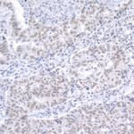 RAP1 Polyclonal Antibody