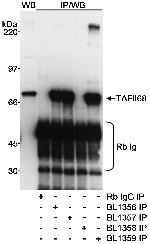 TAFII68 Antibody in Western Blot (WB)
