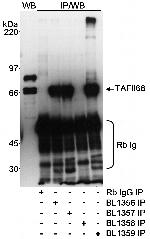 TAFII68 Antibody in Western Blot (WB)