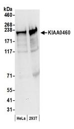 KIAA0460 Polyclonal Antibody