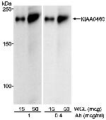 KIAA0460 Antibody in Western Blot (WB)