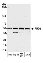 PHD2 Polyclonal Antibody