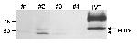 PHD4 Antibody in Western Blot (WB)