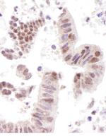 CoAA Polyclonal Antibody