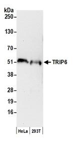 TRIP6 Antibody in Western Blot (WB)