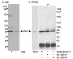 MAD1 Antibody in Western Blot (WB)