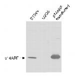 p14ARF Antibody in Western Blot (WB)