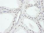 SRC1 Polyclonal Antibody