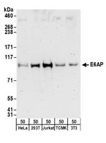 E6AP Polyclonal Antibody