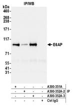 E6AP Antibody in Immunoprecipitation (IP)