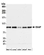 E6AP Polyclonal Antibody