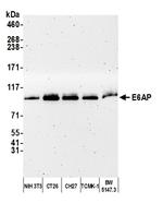 E6AP Antibody in Western Blot (WB)
