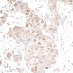 p300 Polyclonal Antibody