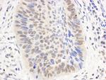 p300 Polyclonal Antibody