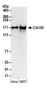 CA150 Antibody in Western Blot (WB)
