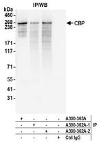 CBP Antibody in Immunoprecipitation (IP)