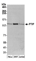 PTIP Polyclonal Antibody