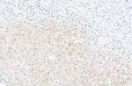 PBEF Polyclonal Antibody
