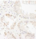 Bub1 Polyclonal Antibody