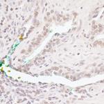 Bcl11b Polyclonal Antibody