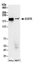 EGFR Antibody in Western Blot (WB)