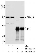DHX15 Antibody in Western Blot (WB)