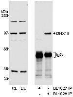 DHX15 Antibody in Western Blot (WB)
