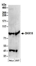 DHX15 Antibody in Western Blot (WB)